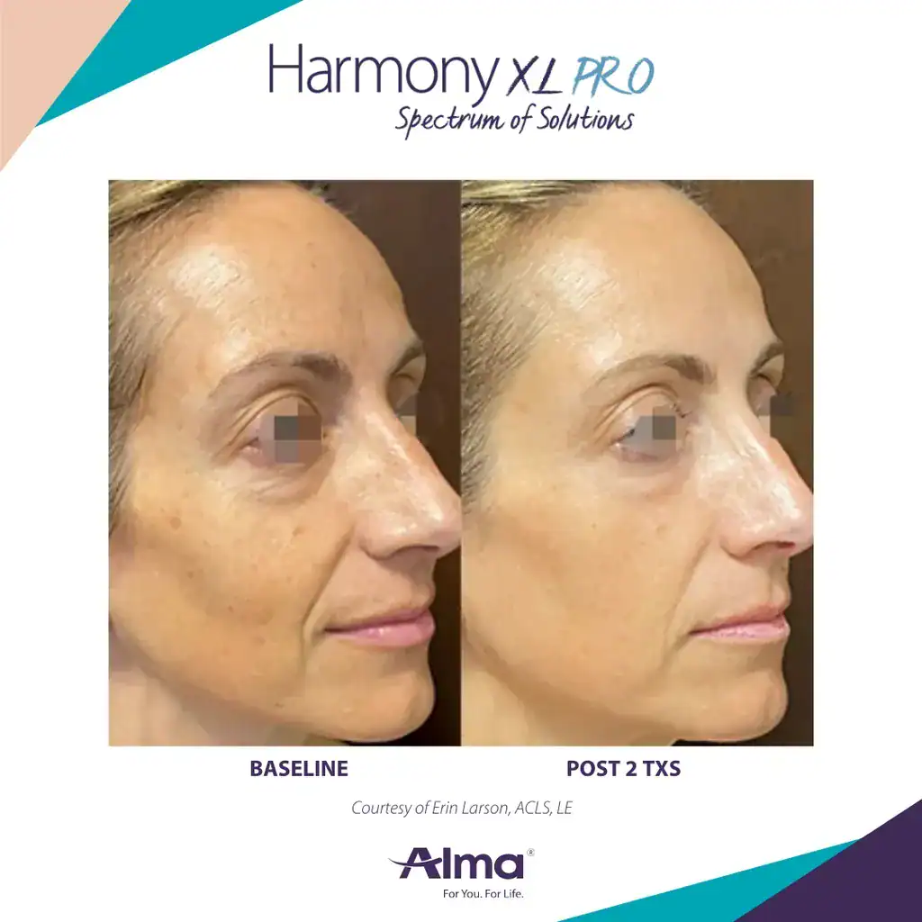 Before and After Treatment at Advantage Primary Care 2