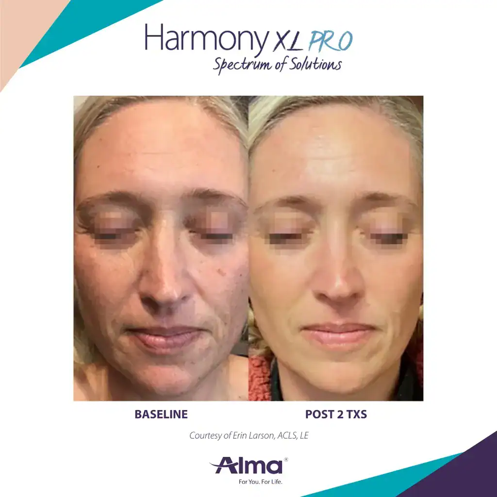 Before and After Treatment at Advantage Primary Care 1