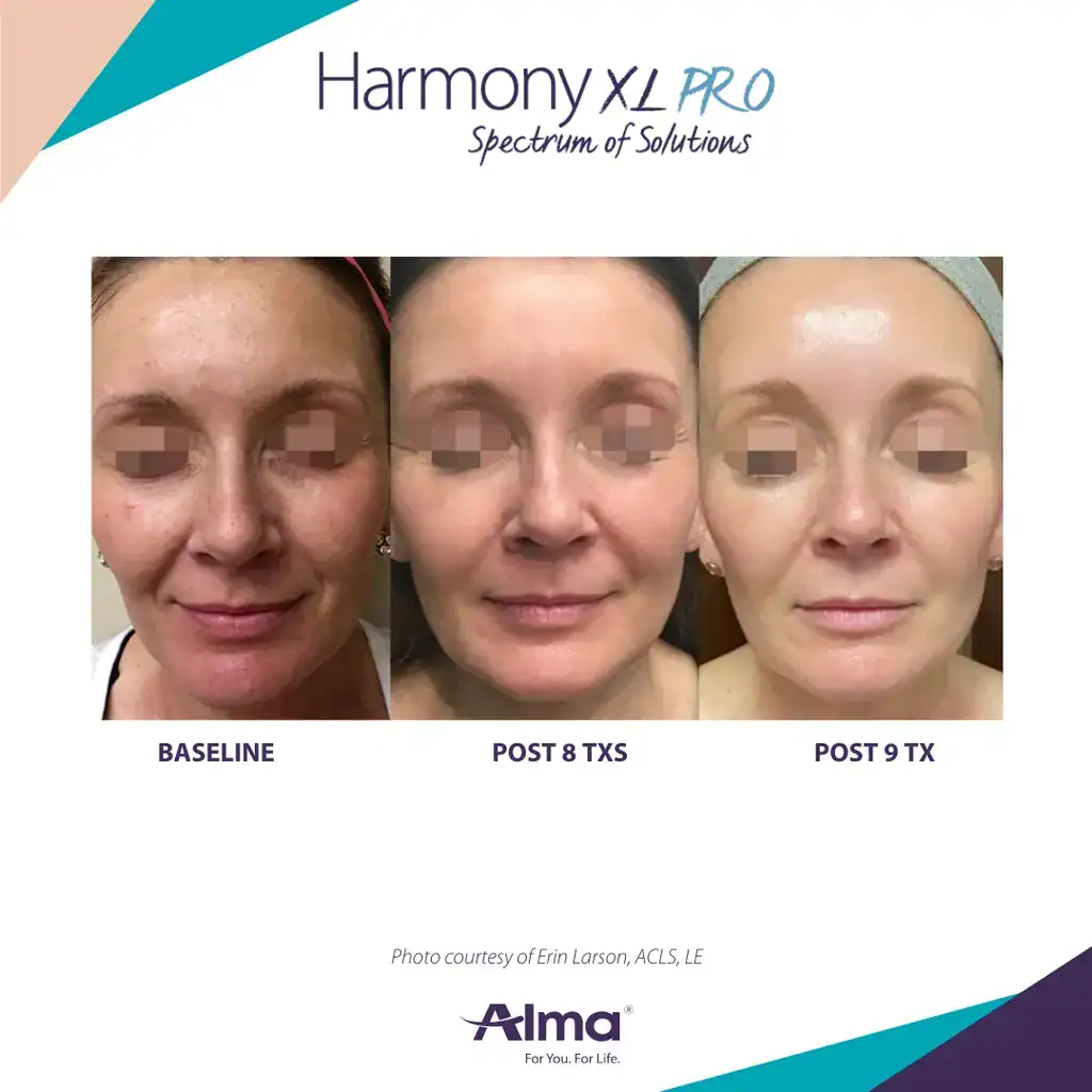 Before and After Treatment at Advantage Primary Care 3