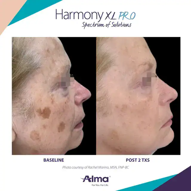 Before and After Treatment at Advantage Primary Care 4