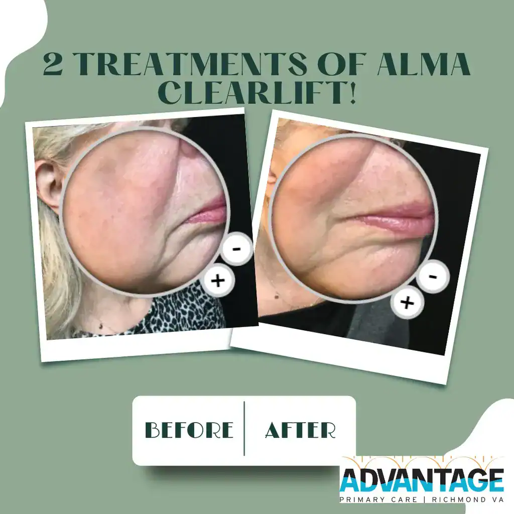 Before and After Treatment at Advantage Primary Care 5
