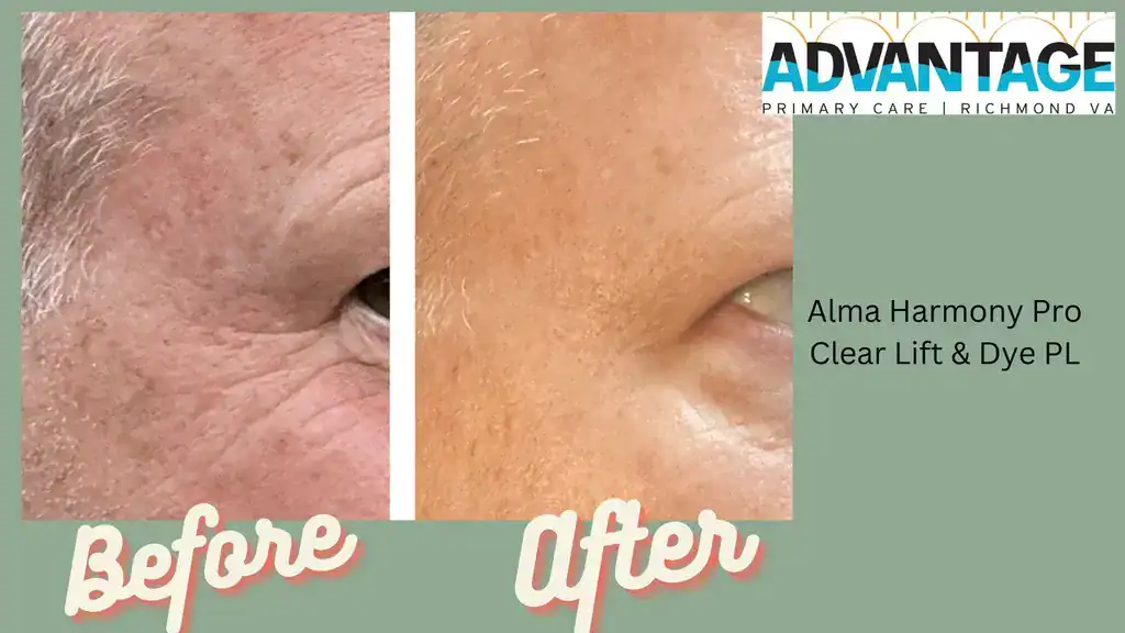 Before and After Treatment at Advantage Primary Care 8