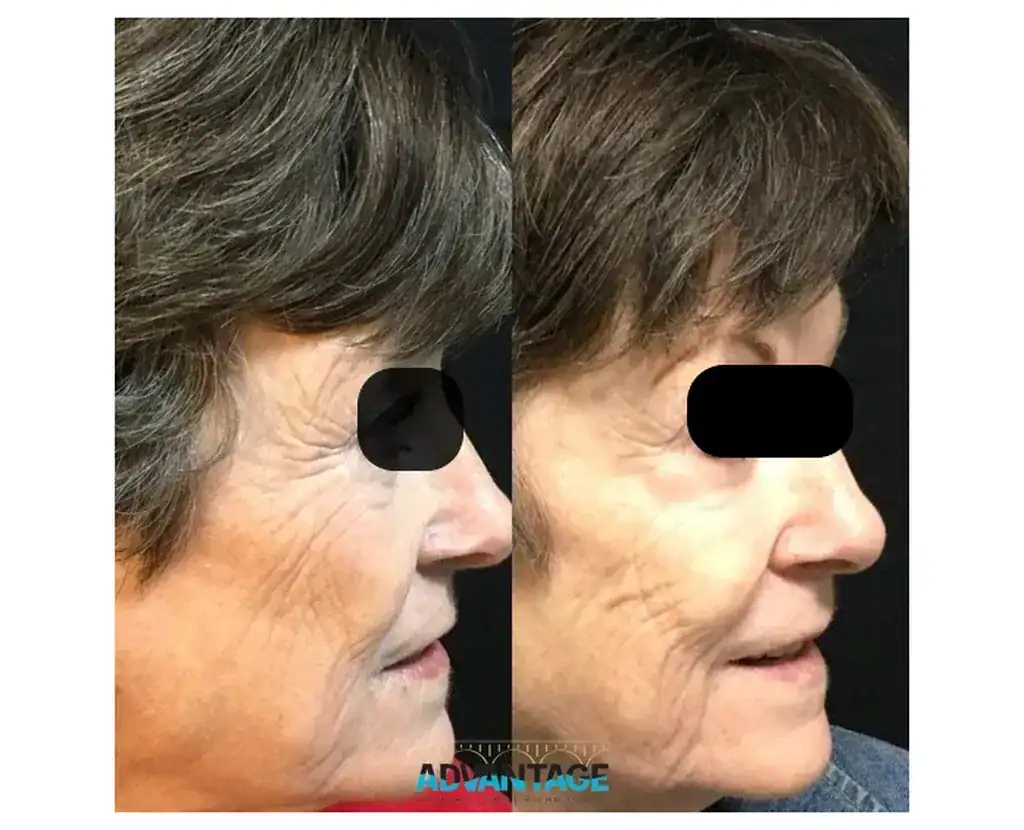 Before and After Treatment at Advantage Primary Care 6