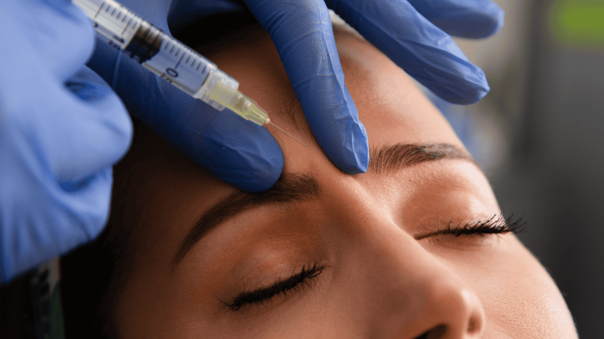 Wrinkle Treatment in Richmond VA